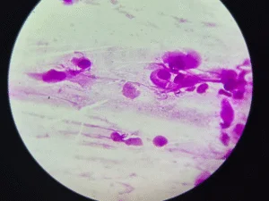 Imagem ilustrativa sobre exame microscopia vaginal em Lavras para investigação de corrimentos e infecções